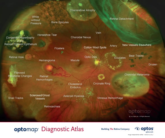 Optomap-Diagnostic-Atlas