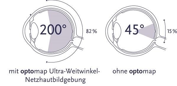 Auge Darstellung DE.jpg