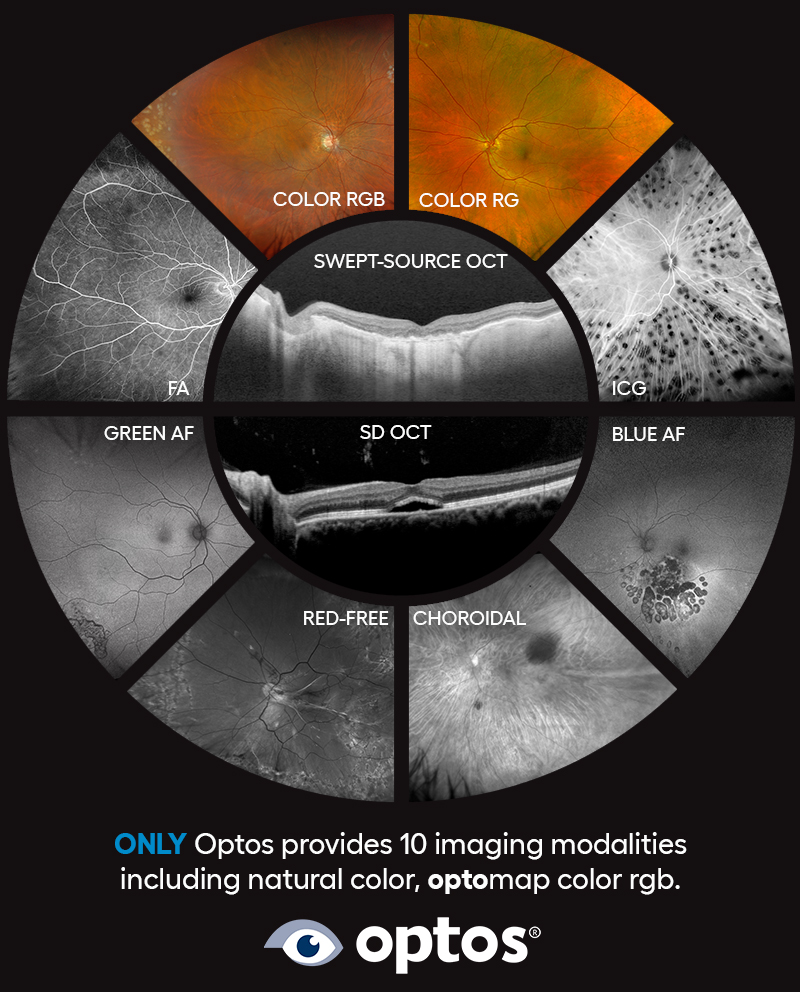 Ten Imaging Modalities of Optos