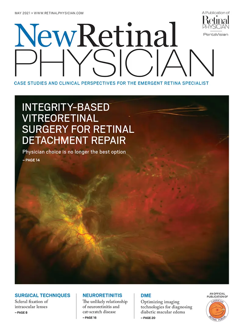 New Retinal Physician May 2021 image