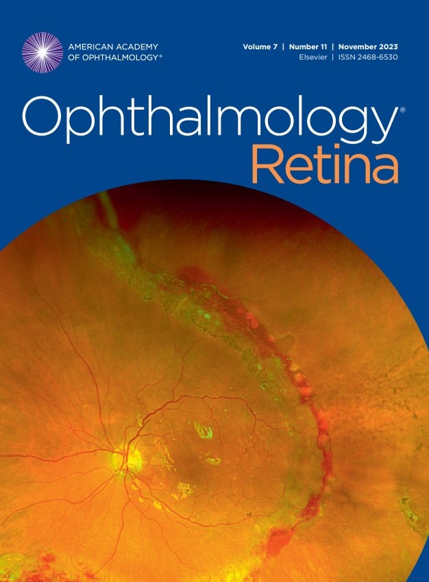 Cotton Wool Spots in a Patient with COVID-19  Published in CRO (Clinical &  Refractive Optometry) Journal