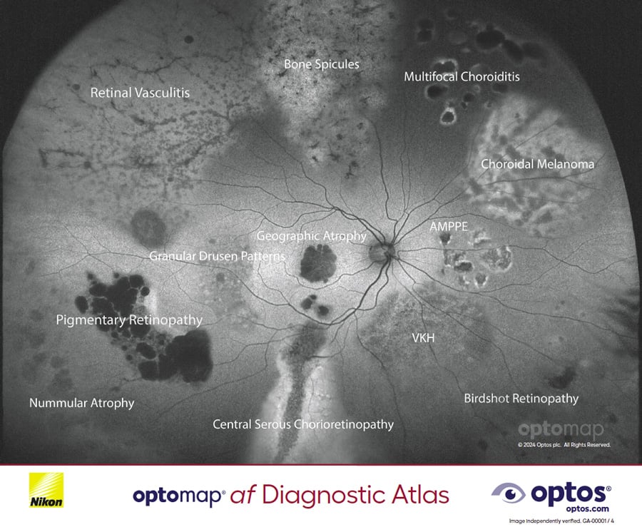 Diagnostic Atlas - optomap af