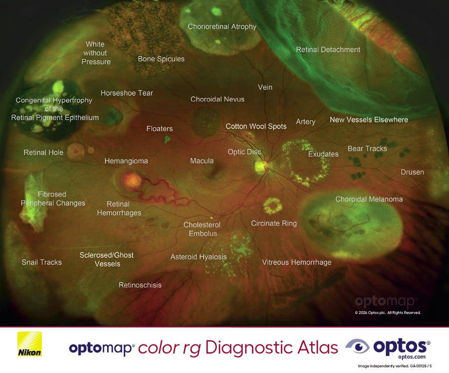 optomap color rg Diagnostic Atlas