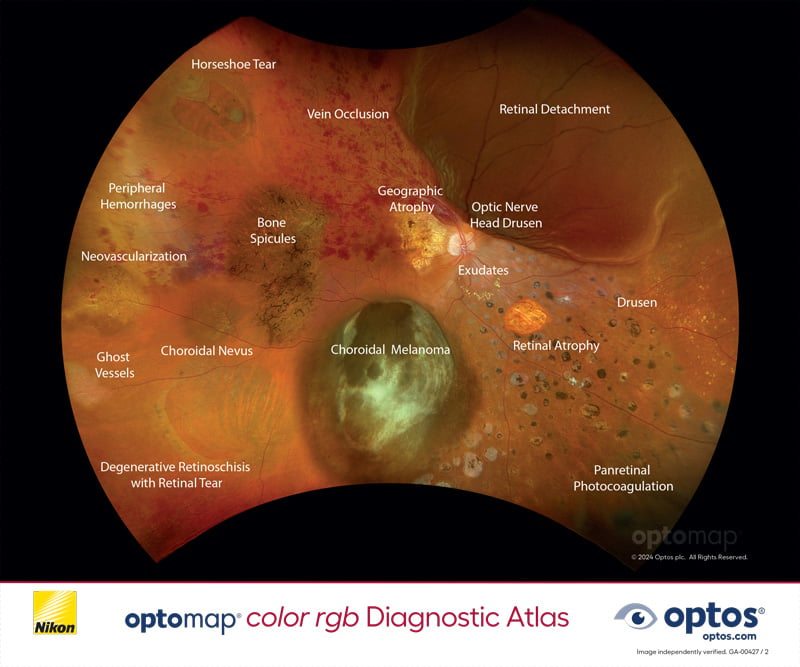 optomap color rgb Diagnostic Atlas