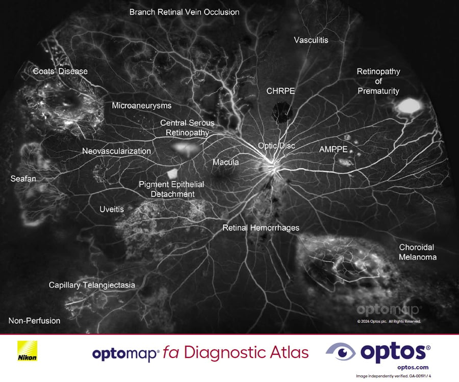 Diagnostic Atlas - optomap fa