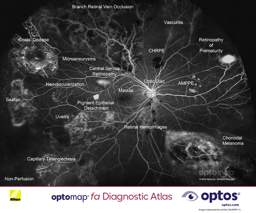 Diagnostic Atlas - optomap fa