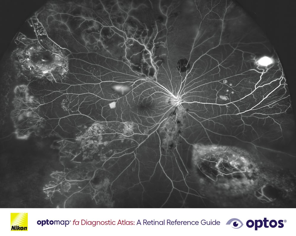 Diagnostic Atlas Booklet – optomap fa