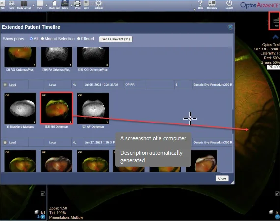 OA Comparing Prior Images Changing Prior Image