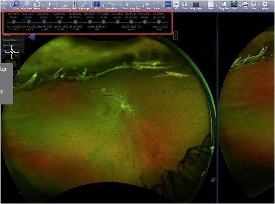 OA Comparing Prior Images Visible Timeline