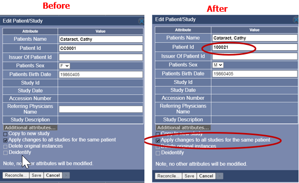 OA Same Patient Two IDs Before After